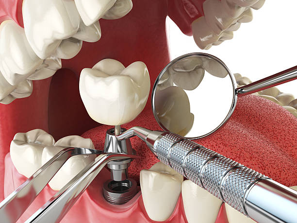 Best Emergency Dental Care for Broken or Chipped Teeth in Leland, MS